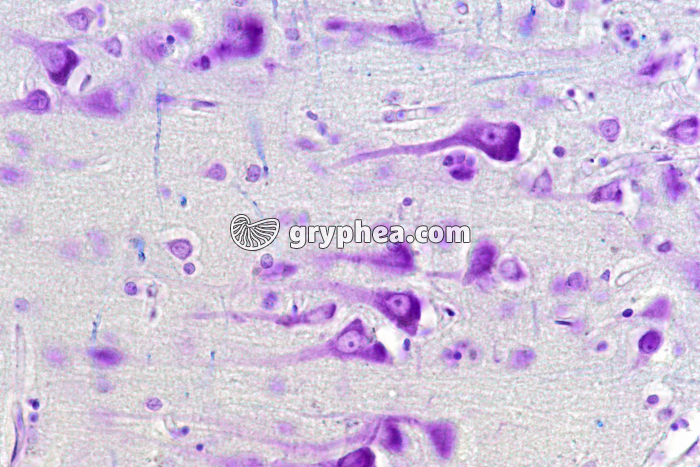 Cerveau humain montrant la substance grise x100 - gryphea.com